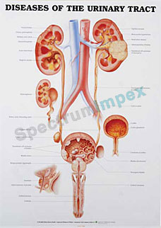Diseases Of The Urinary Tract 