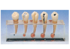 Clinical model of Endodontics