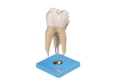 Lower First Upper Molar with Three Roots