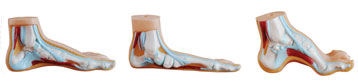 Normal Flat and Arched Foot