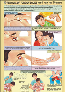 Removal of foreign bodies from eye, ear, nose